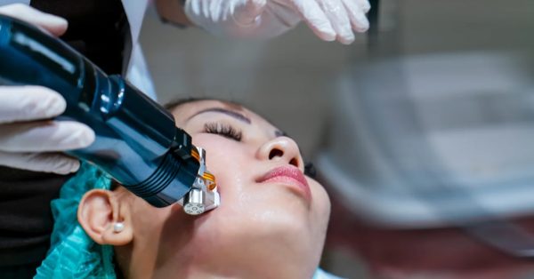 87% off RF Microneedling for Face or Under Eyes for Smoother, Firmer-Looking Skin at Ms Slim at Groupon North America